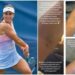 US Open, Stefanini e il livido sul braccio: “Colpa di un controllo antidoping…”