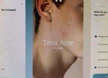 Ai prescrive farmaci contro l’acne, esperti Siiam: “Progresso in Medicina non si misura dal numero di decisioni automatizzate, ma dai benefici concreti per i pazienti”