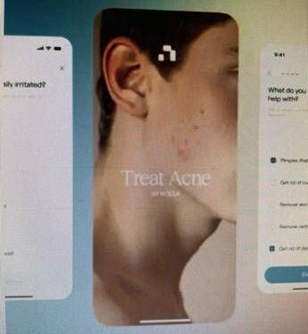 Ai prescrive farmaci contro l’acne, esperti Siiam: “Progresso in Medicina non si misura dal numero di decisioni automatizzate, ma dai benefici concreti per i pazienti”