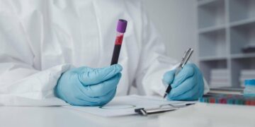 In Francia primo caso umano di virus Shamonda, il paziente è morto: alert Ecdc