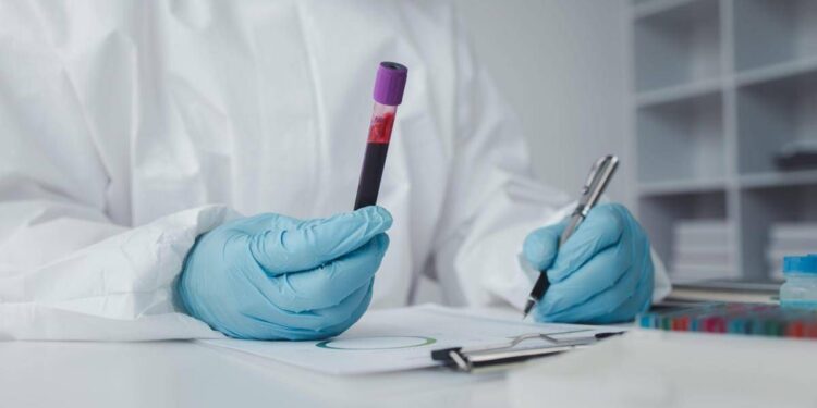 In Francia primo caso umano di virus Shamonda, il paziente è morto: alert Ecdc
